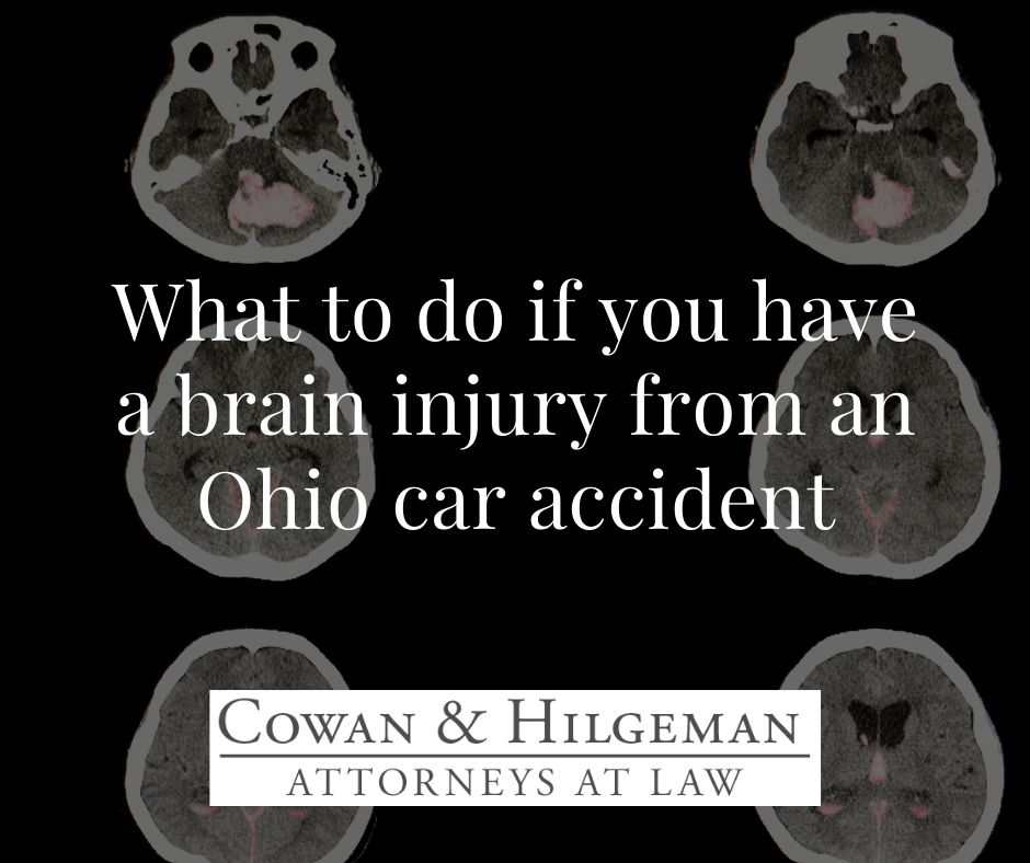 brain injury