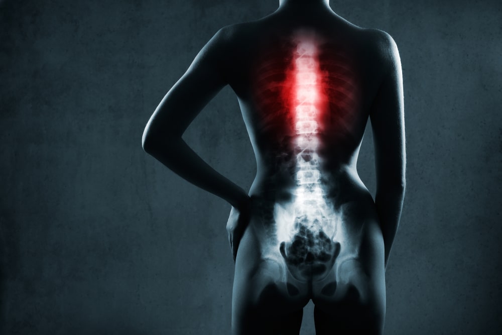 Spinal Cord Injury Lawyer